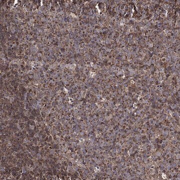 Anti-Rigi Antibody Produced In Rabbit Prestige Antibodies&#174; Powered by Atlas Antibodies, affinity isolated antibody, buffered aqueous glycerol solution