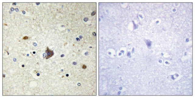 抗胶原蛋白IV &#945;3 兔抗 affinity isolated antibody