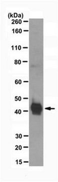 Anti-Chitinase-3-like protein 1 (YKL-40) Antibody, clone mAY clone mAY, from mouse