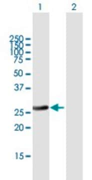 Anti-RAB32 antibody produced in mouse purified immunoglobulin, buffered aqueous solution