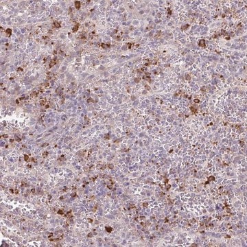 Anti-TAF1D antibody produced in rabbit Prestige Antibodies&#174; Powered by Atlas Antibodies, affinity isolated antibody, buffered aqueous glycerol solution