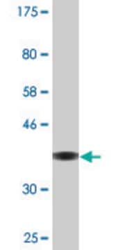 Monoclonal Anti-IFT122 antibody produced in mouse clone 3E11, purified immunoglobulin, buffered aqueous solution