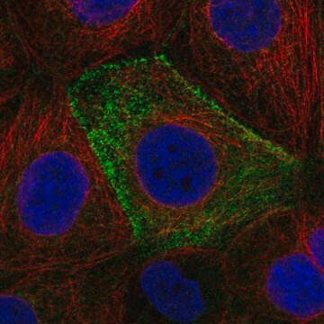 Anti-Csad Antibody Produced In Rabbit Prestige Antibodies&#174; Powered by Atlas Antibodies, affinity isolated antibody, buffered aqueous glycerol solution