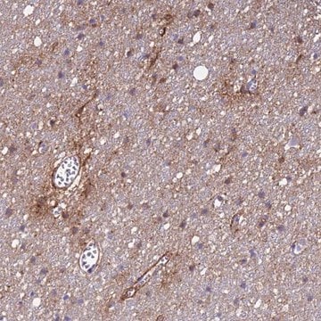 Anti-P2RX7 antibody produced in rabbit Prestige Antibodies&#174; Powered by Atlas Antibodies, affinity isolated antibody, buffered aqueous glycerol solution