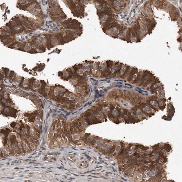 Anti-PMVK antibody produced in rabbit Prestige Antibodies&#174; Powered by Atlas Antibodies, affinity isolated antibody, buffered aqueous glycerol solution