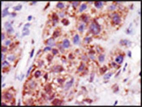 Anti-UBCE7IP5 (center) antibody produced in rabbit IgG fraction of antiserum, buffered aqueous solution