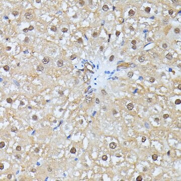 Anti-UBC antibody produced in rabbit