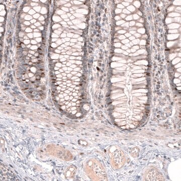 Anti-FOXM1 antibody produced in rabbit Prestige Antibodies&#174; Powered by Atlas Antibodies, affinity isolated antibody, buffered aqueous glycerol solution