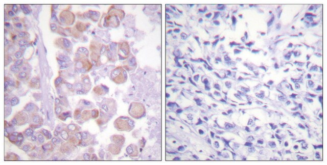 Anti-Synuclein antibody produced in rabbit affinity isolated antibody