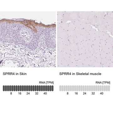 Anti-SPRR4 antibody produced in rabbit Prestige Antibodies&#174; Powered by Atlas Antibodies, affinity isolated antibody, buffered aqueous glycerol solution