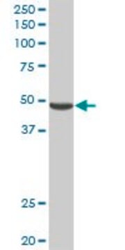 Anti-PNLIPRP2 antibody produced in rabbit purified immunoglobulin, buffered aqueous solution