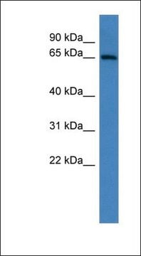 Anti-ADAM23 antibody produced in rabbit affinity isolated antibody