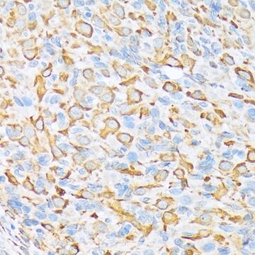 Anti-Sec23A antibody produced in rabbit