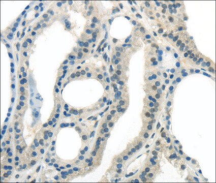 Anti-ENTPD1 affinity isolated antibody