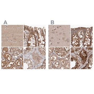 Anti-CEP350 antibody produced in rabbit Prestige Antibodies&#174; Powered by Atlas Antibodies, affinity isolated antibody, buffered aqueous glycerol solution, ab2