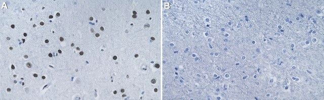 Anti-Histone Macro H2A.1 Antibody, clone 1M7 ZooMAb&#174; Rabbit Monoclonal recombinant, expressed in HEK 293 cells