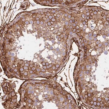 Anti-MAP1LC3B antibody produced in rabbit Prestige Antibodies&#174; Powered by Atlas Antibodies, affinity isolated antibody, buffered aqueous glycerol solution