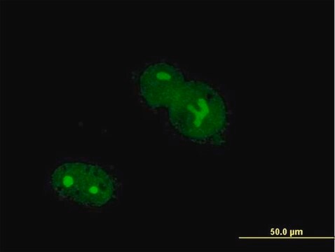 Anti-ZNF32 antibody produced in mouse purified immunoglobulin, buffered aqueous solution