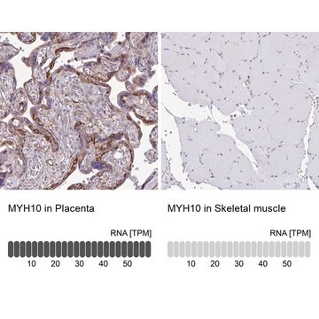 Anti-MYH10 antibody produced in rabbit Prestige Antibodies&#174; Powered by Atlas Antibodies, affinity isolated antibody, buffered aqueous glycerol solution