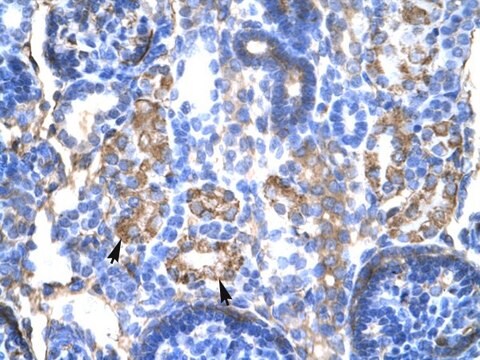 Anti-SERPINA1 (C-terminal) antibody produced in rabbit affinity isolated antibody