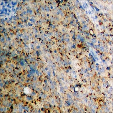 Anti-phospho-CXCR4 (pSer339) antibody produced in rabbit affinity isolated antibody