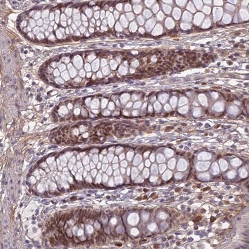 Anti-PABPN1L antibody produced in rabbit Prestige Antibodies&#174; Powered by Atlas Antibodies, affinity isolated antibody, buffered aqueous glycerol solution