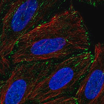 Anti-TM4SF20 antibody produced in rabbit Prestige Antibodies&#174; Powered by Atlas Antibodies, affinity isolated antibody