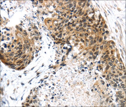 Anti-TRIM74 affinity isolated antibody