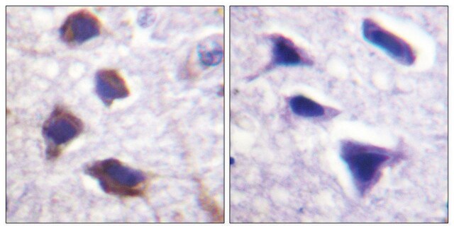 Anti-Adrenergic Receptor &#946;2 antibody produced in rabbit affinity isolated antibody