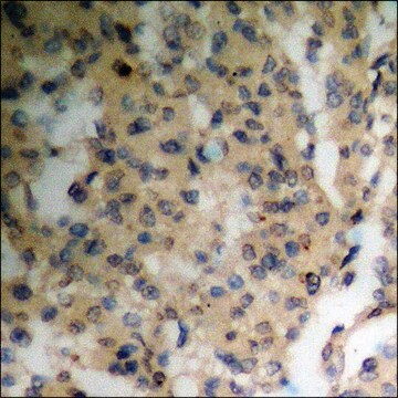 Anti-phospho-PKC &#945; (pThr638) antibody produced in rabbit affinity isolated antibody