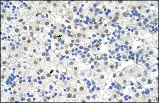 Anti-NOBOX (AB1) antibody produced in rabbit affinity isolated antibody