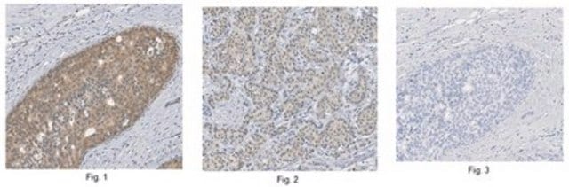 Anti-MLL2 (C-Term) Antibody from rabbit, purified by affinity chromatography