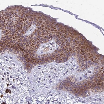 Anti-MVB12A antibody produced in rabbit Prestige Antibodies&#174; Powered by Atlas Antibodies, affinity isolated antibody, buffered aqueous glycerol solution