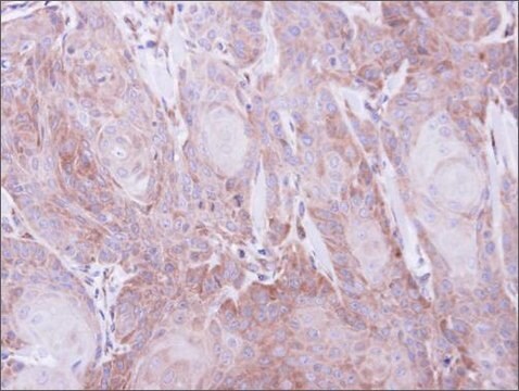 抗SEC61A1抗体 ウサギ宿主抗体 affinity isolated antibody, buffered aqueous solution