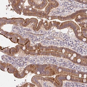 Anti-CXorf40B antibody produced in rabbit Prestige Antibodies&#174; Powered by Atlas Antibodies, affinity isolated antibody, buffered aqueous glycerol solution