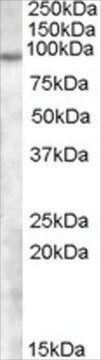 Anti-TCHHL1 antibody produced in goat affinity isolated antibody, buffered aqueous solution