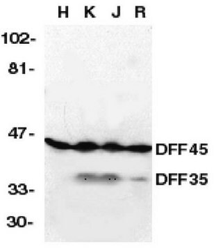 Anti-DFF45/35 Antibody, NT Chemicon&#174;, from rabbit