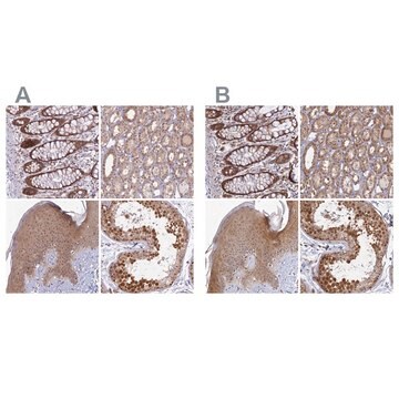 Anti-WDR61 antibody produced in rabbit Prestige Antibodies&#174; Powered by Atlas Antibodies, affinity isolated antibody, buffered aqueous glycerol solution