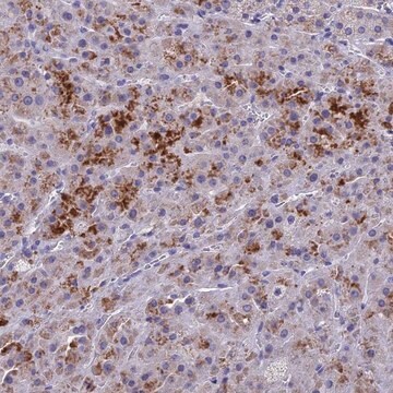 Anti-BTBD19 antibody produced in rabbit Prestige Antibodies&#174; Powered by Atlas Antibodies, affinity isolated antibody, buffered aqueous glycerol solution