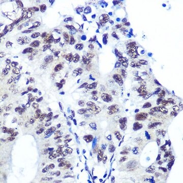 Anti-Ku70 antibody produced in rabbit