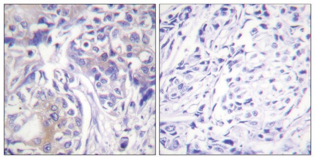 Anti-ADD1 antibody produced in rabbit affinity isolated antibody