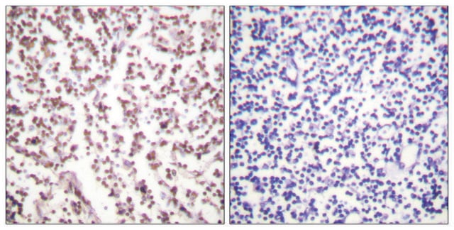 Anti-Bloom Syndrome antibody produced in rabbit affinity isolated antibody