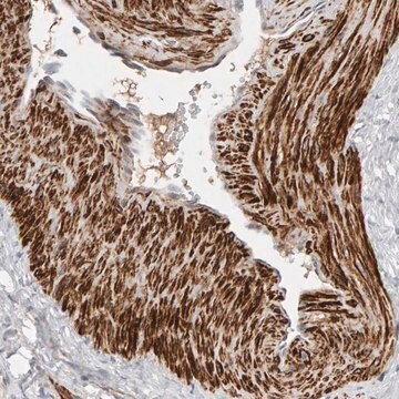 Anti-NUDCD1 antibody produced in rabbit Prestige Antibodies&#174; Powered by Atlas Antibodies, affinity isolated antibody, buffered aqueous glycerol solution