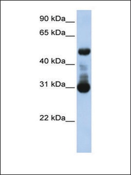 Anti-ACVRL1 antibody produced in rabbit affinity isolated antibody