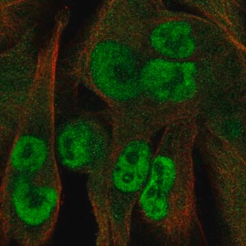 Anti-Kctd15 Antibody Produced In Rabbit Prestige Antibodies&#174; Powered by Atlas Antibodies, affinity isolated antibody, buffered aqueous glycerol solution