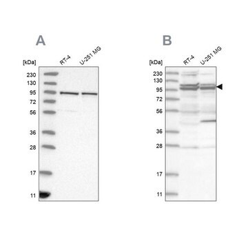 Anti-TBC1D5 antibody produced in rabbit Prestige Antibodies&#174; Powered by Atlas Antibodies, affinity isolated antibody, buffered aqueous glycerol solution