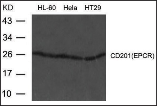 Anti-PROCR antibody produced in rabbit affinity isolated antibody