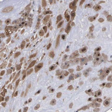 Anti-FAM110B antibody produced in rabbit Prestige Antibodies&#174; Powered by Atlas Antibodies, affinity isolated antibody, buffered aqueous glycerol solution