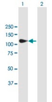 Anti-MATN2 antibody produced in mouse purified immunoglobulin, buffered aqueous solution