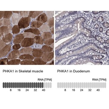 Anti-PHKA1 antibody produced in rabbit Prestige Antibodies&#174; Powered by Atlas Antibodies, affinity isolated antibody, buffered aqueous glycerol solution